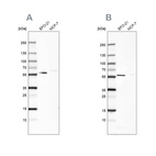 Western blot analysis using Anti-PDP1 antibody HPA019081 (A) shows similar pattern to independent antibody HPA021152 (B).