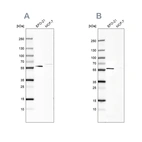 Western blot analysis using Anti-PDP1 antibody HPA019081 (A) shows similar pattern to independent antibody HPA021152 (B).