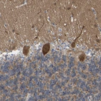 Immunohistochemical staining of human cerebellum shows strong cytoplasmic positivity in Purkinje cells.