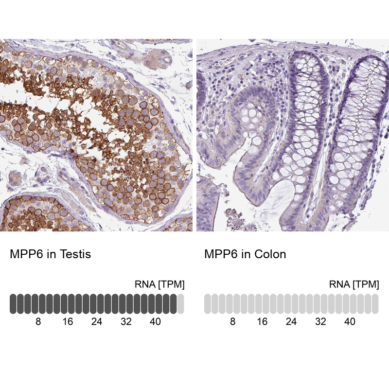Anti-MPP6 Antibody