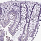 Immunohistochemical staining of human colon shows low expression as expected.