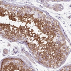 Immunohistochemical staining of human testis shows high expression.
