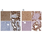 Immunohistochemical staining of human cerebral cortex, kidney, pancreas and prostate using Anti-CRYM antibody HPA019086 (A) shows similar protein distribution across tissues to independent antibody HPA030619 (B).