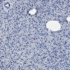 Immunohistochemical staining of human pancreas shows no positivity in exocrine glandular cells as expected.
