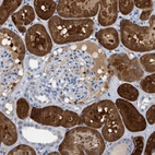 Immunohistochemical staining of human kidney shows strong cytoplasmic positivity in cells in tubules.