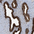 Immunohistochemical staining of human prostate shows strong cytoplasmic positivity in glandular cells.