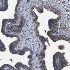Immunohistochemical staining of human Fallopian tube shows moderate cytoplasmic positivity in glandular cells.