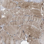 Immunohistochemical staining of human Skeletal muscle shows moderate cytoplasmic positivity in myocytes.