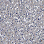 Anti-IFT81 Antibody