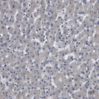 Immunohistochemical staining of human Liver shows very weak cytoplasmic positivity in hepatocytes.