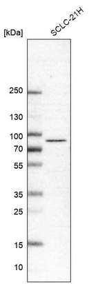 Western blot analysis in human cell line SCLC-21H.