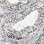 Immunohistochemical staining of human testis shows strong positivity in nuclear membrane in cells in seminiferous ducts.