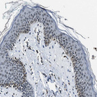 Immunohistochemical staining of human skin shows moderate positivity in nuclear membrane in squamous epithelial cells.