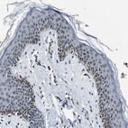 Anti-ZC3HC1 Antibody