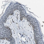 Immunohistochemical staining of human skin shows moderate positivity in nuclear membrane in squamous epithelial cells.
