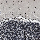 Immunohistochemical staining of human cerebellum shows moderate positivity in nuclear membrane in Purkinje cells and cells in molecular layer.