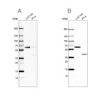 Western blot analysis using Anti-ZC3HC1 antibody HPA019089 (A) shows similar pattern to independent antibody HPA024023 (B).