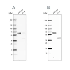 Western blot analysis using Anti-ZC3HC1 antibody HPA019089 (A) shows similar pattern to independent antibody HPA024023 (B).