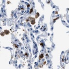 Immunohistochemical staining of human lung using Anti-CAPG antibody HPA019092.