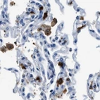 Immunohistochemical staining of human lung using Anti-CAPG antibody HPA019092.