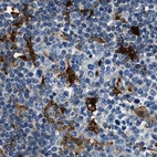 Immunohistochemical staining of human lymph node using Anti-CAPG antibody HPA019092.