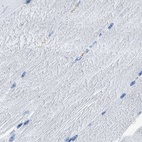 Immunohistochemical staining of human skeletal muscle using Anti-CAPG antibody HPA019092.