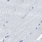 Immunohistochemical staining of human skeletal muscle using Anti-CAPG antibody HPA019092.