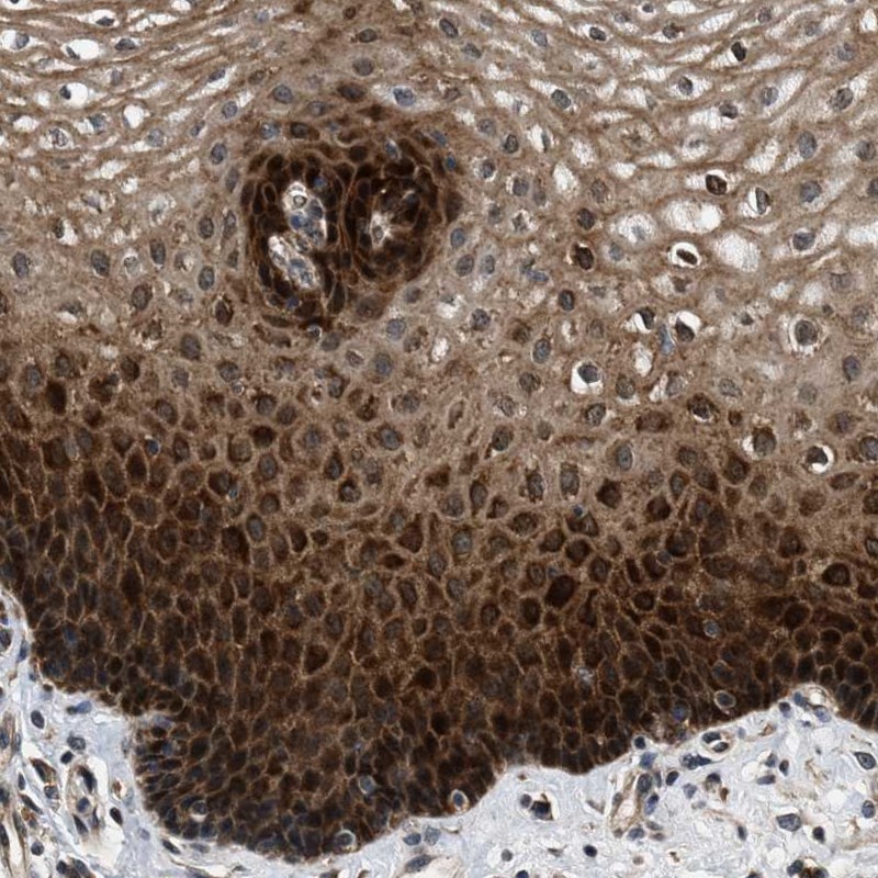 Anti-PRDM14 Antibody