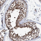Immunohistochemical staining of human Testis shows strong cytoplasmic positivity in cells in seminiferous ducts.