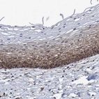 Immunohistochemical staining of human Cervix shows moderate cytoplasmic positivity in squamous epithelial cells.