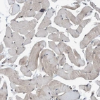 Immunohistochemical staining of human Skeletal muscle shows very weak cytoplasmic positivity in myocytes.
