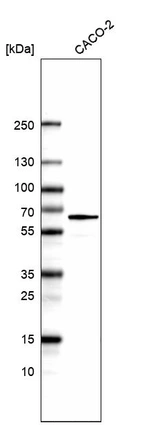 Western blot analysis in human cell line CACO-2.