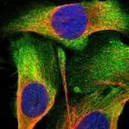 Immunofluorescent staining of human cell line U-2 OS shows localization to plasma membrane & cytosol.