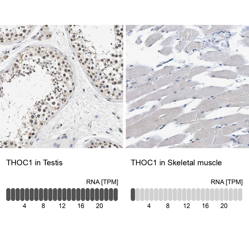 Anti-THOC1 Antibody
