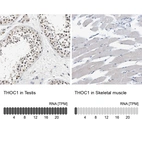Anti-THOC1 Antibody