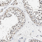 Immunohistochemical staining of human testis shows moderate nuclear positivity in cells in seminiferous ducts.