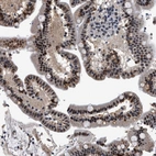 Immunohistochemical staining of human duodenum shows moderate nuclear positivity in glandular cells.