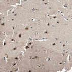 Immunohistochemical staining of human cerebral cortex shows strong nuclear positivity in neuronal cells.
