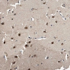 Immunohistochemical staining of human cerebral cortex shows strong nuclear positivity in neuronal cells.
