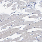 Immunohistochemical staining of human skeletal muscle shows no nuclear positivity in myocytes as expected.