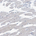 Immunohistochemical staining of human skeletal muscle shows no nuclear positivity in myocytes as expected.