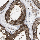 Immunohistochemical staining of human testis shows strong cytoplasmic positivity in cells in seminiferous ducts.