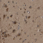 Immunohistochemical staining of human cerebral cortex shows moderate cytoplasmic positivity in neurons.