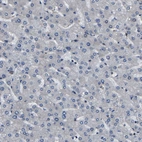 Immunohistochemical staining of human liver shows very weak cytoplasmic positivity in hepatocytes.