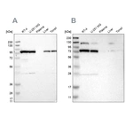 Western blot analysis using Anti-GARS antibody HPA019097 (A) shows similar pattern to independent antibody HPA017896 (B).