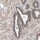 Immunohistochemical staining of human prostate shows moderate to strong cytoplasmic positivity in glandular cells.