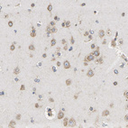 Immunohistochemical staining of human cerebral cortex shows weak to moderate cytoplasmic positivity in neurons.