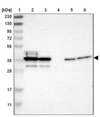 Lane 1: Marker [kDa] 230, 130, 95, 72, 56, 36, 28, 17, 11_br/_Lane 2: Human cell line RT-4_br/_Lane 3: Human cell line U-251MG sp_br/_Lane 4: Human plasma (IgG/HSA depleted)_br/_Lane 5: Human liver tissue_br/_Lane 6: Human tonsil tissue