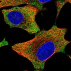 Immunofluorescent staining of human cell line A549 shows localization to cytosol.
