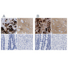 Immunohistochemical staining of human bronchus, cerebral cortex, colon and liver using Anti-HAPLN1 antibody HPA019105 (A) shows similar protein distribution across tissues to independent antibody HPA019482 (B).